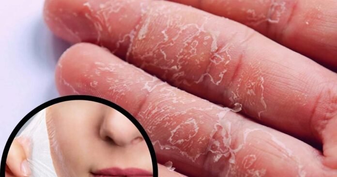 ज्यादा देर धूप में रहने से हो सकता है Skin Cancer? सर्दियों में आप भी धूप सेंकते हैं तो हो जाएं सावधान